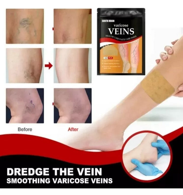 VEINS™- Parches Antivárices